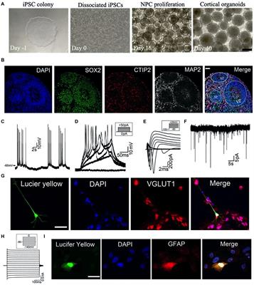 Methadone Suppresses Neuronal Function and Maturation in Human Cortical Organoids